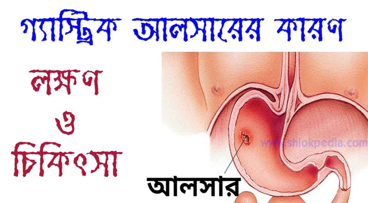 গ্যাস্ট্রিক আলসারের লক্ষন ও প্রতিকার