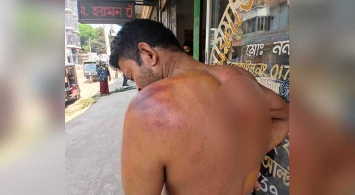 যৌন হয়রানিতে বাধা দেয়ায় মাংসের দোকানের কর্মচারীকে মারধর