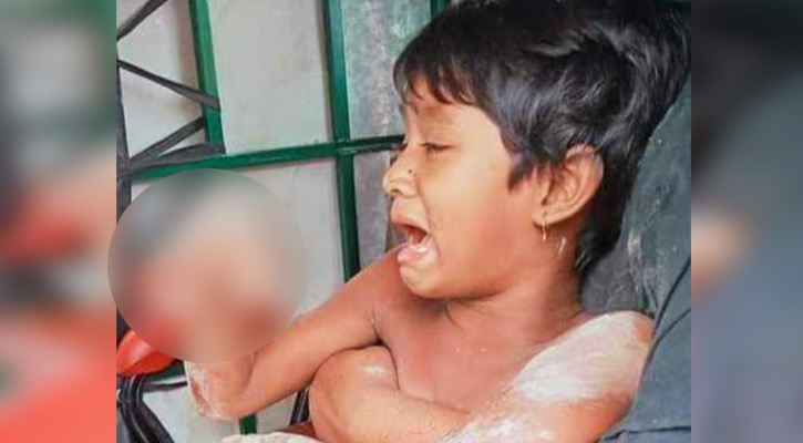 নান্দাইলে পাগলা কুকুরের কামড়ে আহত ২৭