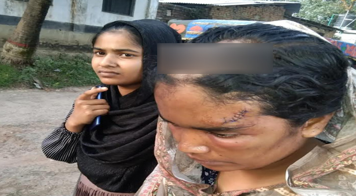 আদমদীঘিতে গৃহবধূকে মারধর, পুলিশের তৎপরতা নেই