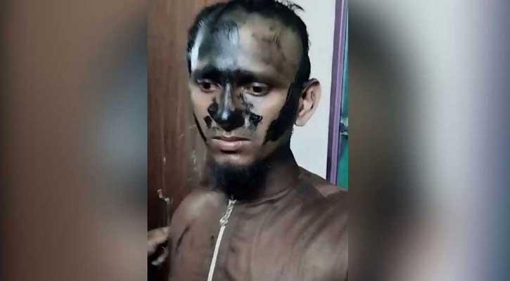 মাথা মুড়িয়ে শিক্ষকের মুখে আলকাতরা দিল স্থানীয়রা