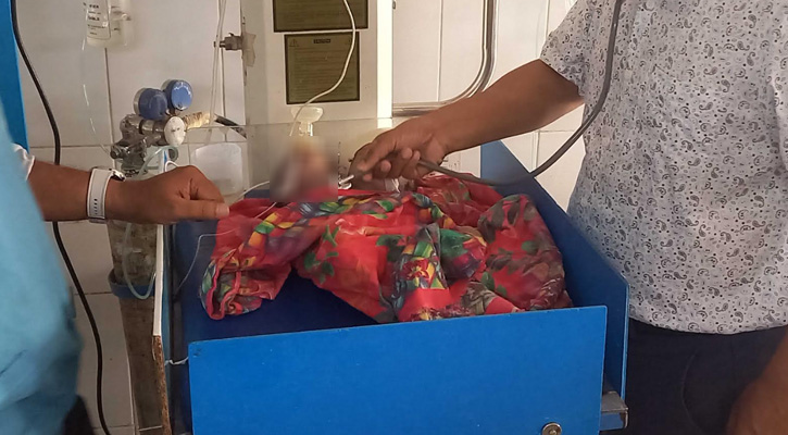 পঞ্চগড়ে জন্ম নিল দুই মাথাওয়ালা নবজাতক, মৃত্যুর খবর দুপুরেই