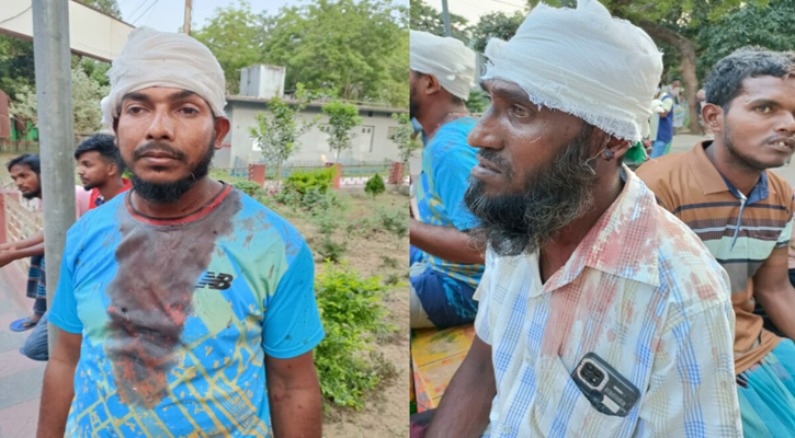 তানোরে তুচ্ছ ঘটনাকে কেন্দ্র করে দেশীয় অস্ত্র নিয়ে মারপিট আহত ৪