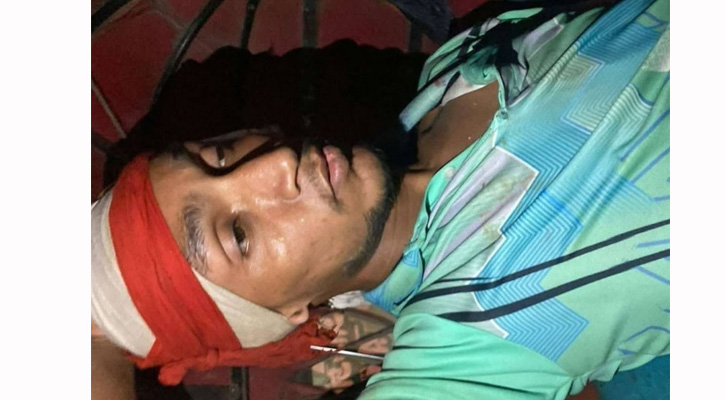 তিতাসে কিশোর গ্যাংয়ের সন্ত্রাসী হামলায় যুবক আহত