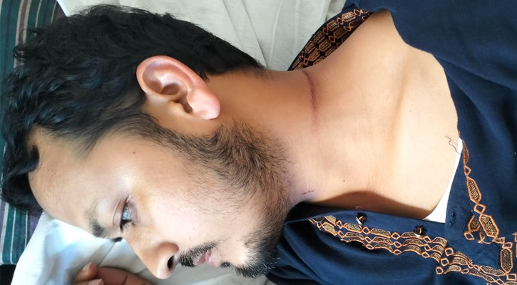 উজিরপুরে জামায়েত নেতার গলায় ফাঁস দিয়ে হত্যার চেষ্টা