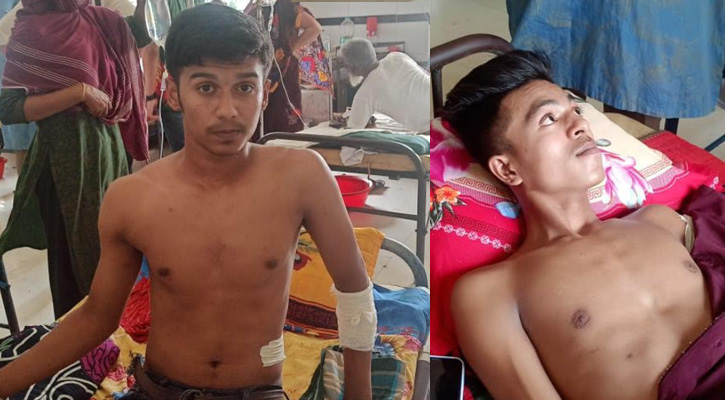 জখম নিয়েই পরীক্ষা দিল দুই এসএসসি পরীক্ষার্থী