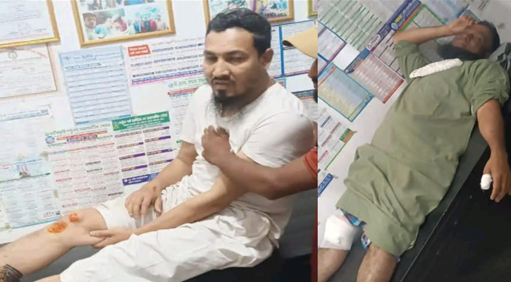 বাইক দুর্ঘটনায় গুরুতর আহত একুশে সংবাদ‍‍`র ফটিকছড়ি প্রতিনিধি সাংবাদিক আসগর সালেহী