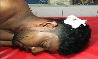 লালপুরে মুখোশধারী দুর্ধর্ষ ডাকাতি: আইনজীবীসহ আহত ৩
