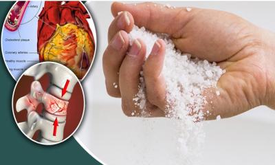 কাঁচা লবণ খেলে কী ক্ষতি হতে পারে? জানুন এর প্রভাব
