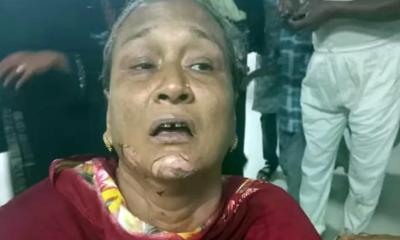 চলন্ত অটোরিকশায় ‘পেট্রোল বোমা’ নিক্ষেপ, দগ্ধ ২ নারী