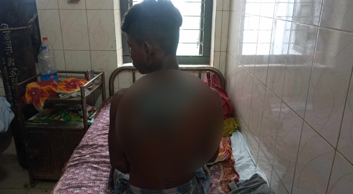 কেটলির গরম পানিতে ঝলসে দিল শিশুর শরীর