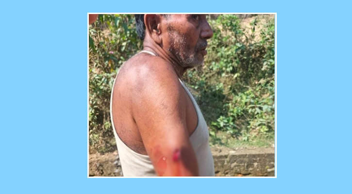 মিয়ানমার থেকে ছোড়া গুলিতে আহত বাংলাদেশি