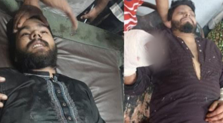সিলেটে ছাত্রলীগ নেতাকে কুপিয়ে আহত হওয়ার ঘটনায় দুর্বৃত্তরা এখন ধরা ছোঁয়ার বাহিরে