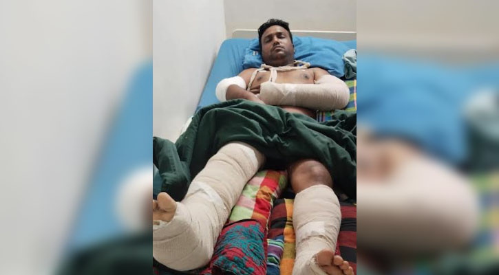যুবলীগ সভাপতিকে হাতুড়ি দিয়ে চার হাত-পা ভেঙ্গে দিল প্রতিপক্ষরা
