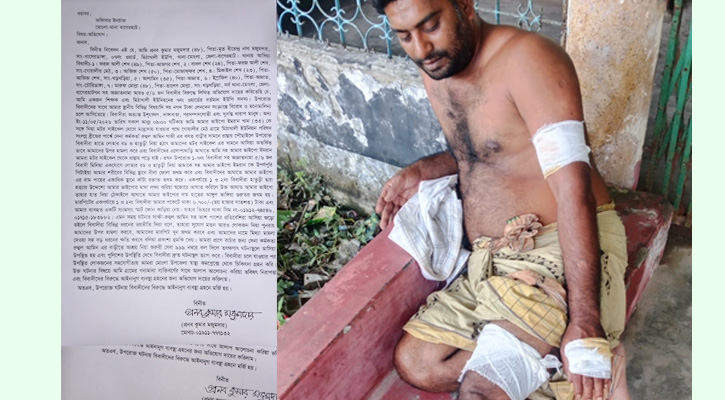 মোংলায় লোহার রড-হাতুড়ি নিয়ে হামলা, আহত ইউপি সদস্য ও তাঁর ভাইপো