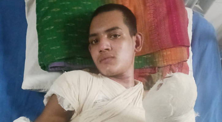 বিদ্যুৎস্পৃষ্ট হয়ে মৃত্যুর সঙ্গে লড়ছেন প্রশান্ত মিস্ত্রি, প্রয়োজন মানবিক সহায়তা