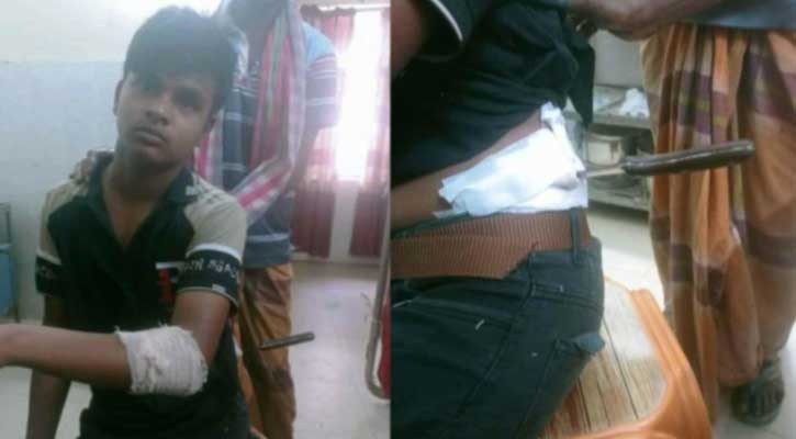 বাকিতে সিগারেট না পেয়ে দোকানদারকে ছুরিকাঘাত