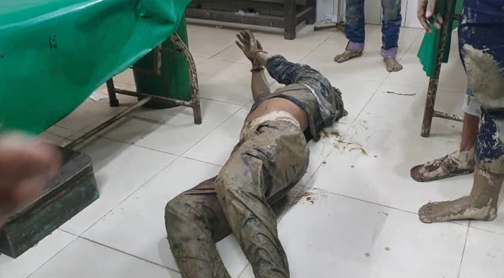 মৌলভীবাজারে ডাকাতের গুলিতে গুলিবিদ্ধ আরেক ডাকাত