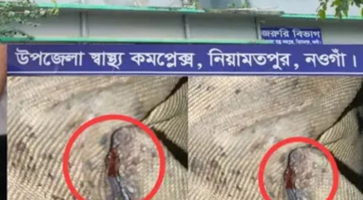 নিয়ামতপুরে শয্যাজুড়ে ছারপোকা, অতিষ্ঠ রোগীরা