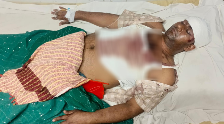 গলাচিপায় জমিজমা নিয়ে পূর্বশত্রুতার জেরে হামলা, গুরুতর আহত ৮