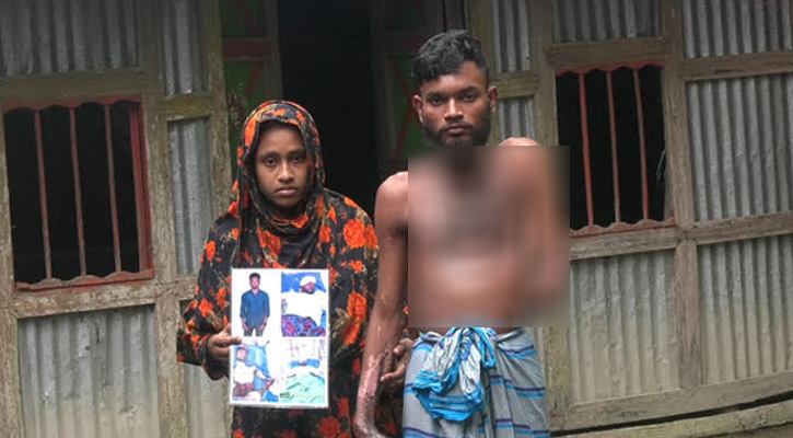 ভোলায় বিদ্যুৎস্পৃষ্টে হাত-পা হারানো মিরাজের পরিবারে অভাবের কান্না