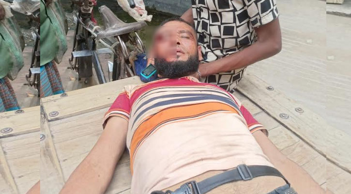 যশোরের অভয়নগরে জমি নিয়ে বিরোধের জেরে হামলা, আহত ১