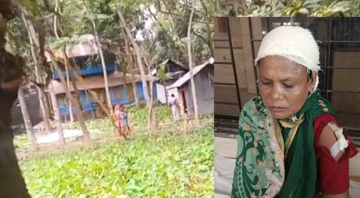 দুমকিতে জমিজমার বিরোধে নারীকে মারধর ও প্রাণনাশের হুমকি