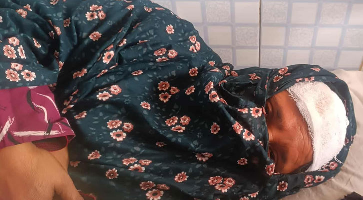 বাউফলে ডাকাতিতে ব্যর্থ হয়ে শিক্ষক ও মেয়েকে কুপিয়ে জখম