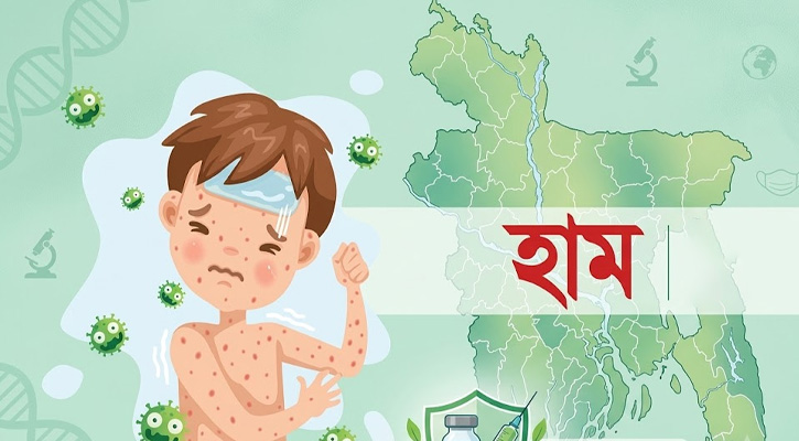 হামের উপসর্গ নিয়ে আরও ৮ শিশুর মৃত্যু