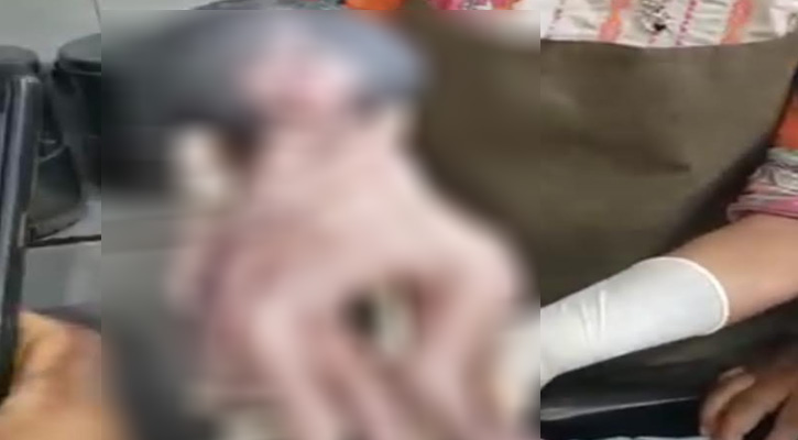 বড়াইগ্রামে পরস্পর আঁকড়ে ধরা দুই শিশুর জন্ম