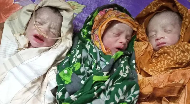 লালপুরে এক গৃহবধূর একসঙ্গে তিন ছেলের জন্ম