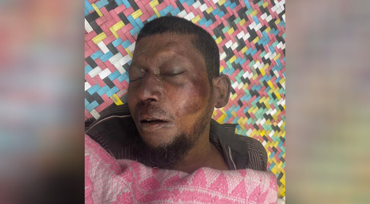 আড়াইহাজারে অটোরিক্সা ও বালুবাহী ট্রাকের সংঘর্ষে নিহত ১