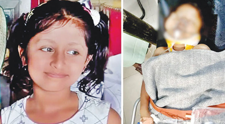 টেকনাফ সীমান্তে গুলিবিদ্ধ সেই শিশু হুজাইফার মৃত্যু
