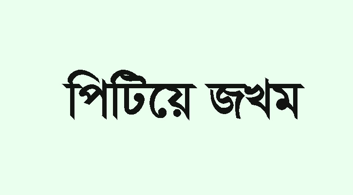 মান্দায় তুচ্ছ ঘটনায় বিধবা নারীকে পিটিয়ে জখম, থানায় অভিযোগ