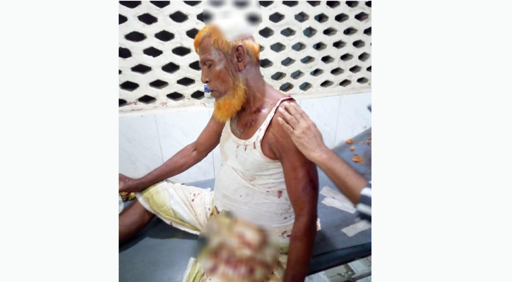 বড়াইগ্রামে আওয়ামী লীগের দুই গ্রুপের পাল্টাপাল্টি হামলায় একজনের মৃত্যু