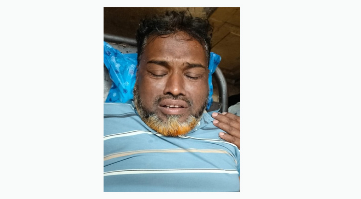 যশোরে ইউপি চেয়ারম্যানকে হাত পা ভেঙে দিলো সন্ত্রাসীরা