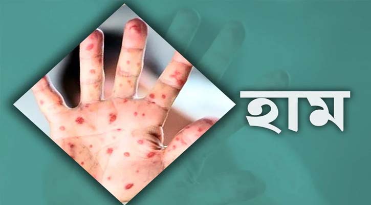 ঝুঁকিপূর্ণ জনগোষ্ঠীকে হামের টিকার আওতায় আনার সুপারিশ
