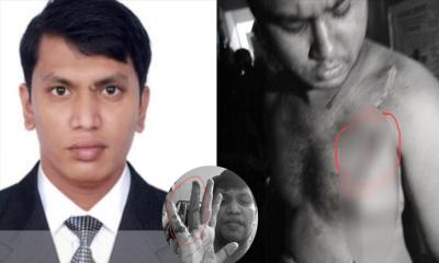 ডাকসুর ভিপি প্রার্থী গভীর রাতে রুমমেটকে ছুরিকাঘাত