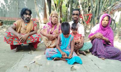 ইসলামপুরে শরীরে প্রাণীদের মত লোম নিয়ে তিনটি পরিবারের মানবেতর জীবন-যাপন