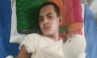 বিদ্যুৎস্পৃষ্ট হয়ে মৃত্যুর সঙ্গে লড়ছেন প্রশান্ত মিস্ত্রি, প্রয়োজন মানবিক সহায়তা