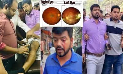 সংগ্রামী জীবন থেকে রাজপথের নেতৃত্বে: গুলিবিদ্ধ হয়েও থামেননি সুজন মোল্লা