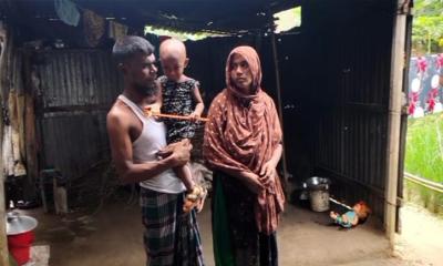 ভালুকার আছিয়া: দেড় বছরের শিশু লড়ছে ব্রেইন ক্যান্সারের সঙ্গে