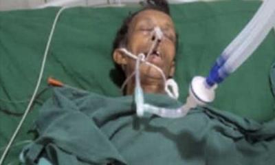 বোয়ালখালীতে সড়ক দুর্ঘটনায় আহত ব্যক্তির চিকিৎসাধীন অবস্থায় মৃত্যু