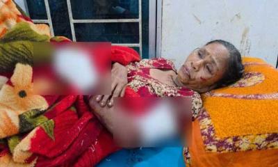 কোটালীপাড়ায় ককটেল বিস্ফোরণে নারী আহত