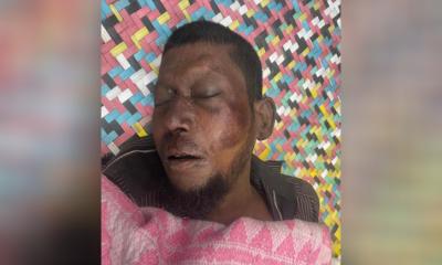 আড়াইহাজারে অটোরিক্সা ও বালুবাহী ট্রাকের সংঘর্ষে নিহত ১