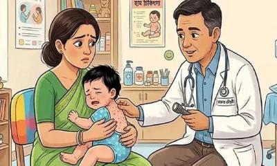 দুই মাসে হাম ও হামের উপসর্গে নিয়ে ৪৫১ জনের মৃত্যু