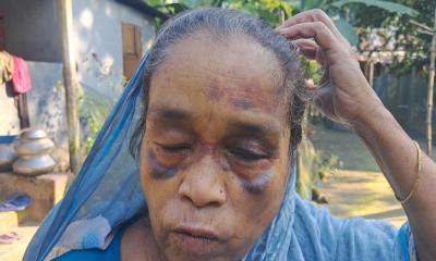 রাজবাড়ীতে জমি বিরোধে বৃদ্ধাকে মারধর, উল্টো মামলায় হয়রানির অভিযোগ