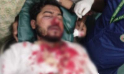 জাপা কার্যালয়ের সামনে ফের হামলা, মারাত্মক আহত নুরুল হক নুর