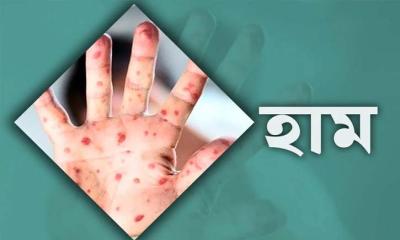 ঝুঁকিপূর্ণ জনগোষ্ঠীকে হামের টিকার আওতায় আনার সুপারিশ