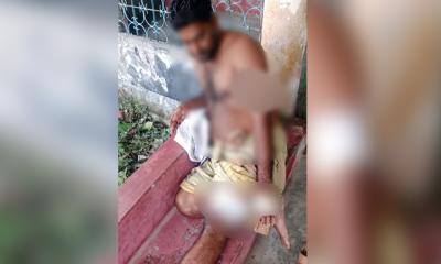 মোংলায় রড-হাতুড়ি হামলায় আহত ইউপি সদস্য ও ভাইপো